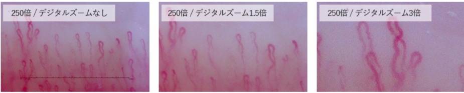 血流ドクターオート 3R-DRAUTO｜高速オートフォーカス搭載のハンディ血流観察機器｜高精細フルHD画質・約2秒で自動ピント調整｜軽量設計で省スペース・美容・健康カウンセリングに最適