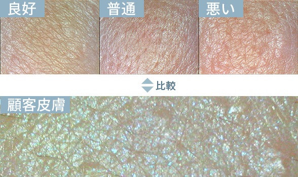 肌カウンセリングスコープ 3R-API100｜高精度7項目分析・肌状態の可視化・商品提案・アフターフォローまで対応・コンパクト＆ワイヤレス設計で場所を選ばず活用できる業務用美肌測定器