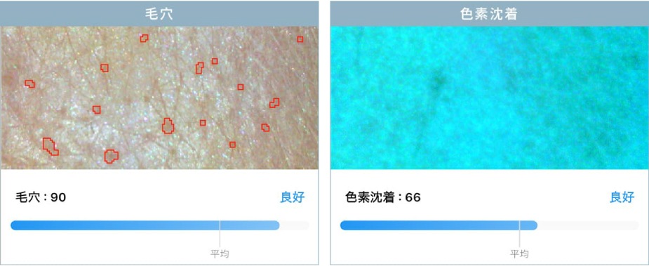 肌カウンセリングスコープ 3R-API100｜高精度7項目分析・肌状態の可視化・商品提案・アフターフォローまで対応・コンパクト＆ワイヤレス設計で場所を選ばず活用できる業務用美肌測定器