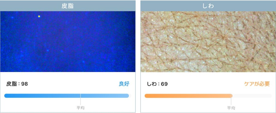 肌カウンセリングスコープ 3R-API100｜高精度7項目分析・肌状態の可視化・商品提案・アフターフォローまで対応・コンパクト＆ワイヤレス設計で場所を選ばず活用できる業務用美肌測定器