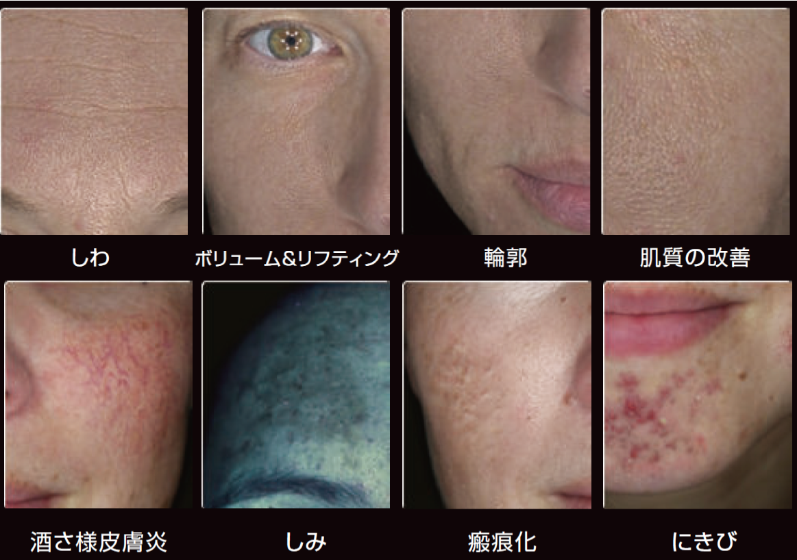 OBSERV 520x｜10モード対応スキン分析機器｜iPad連携で肌の深層まで可視化する美容クリニック向け装置