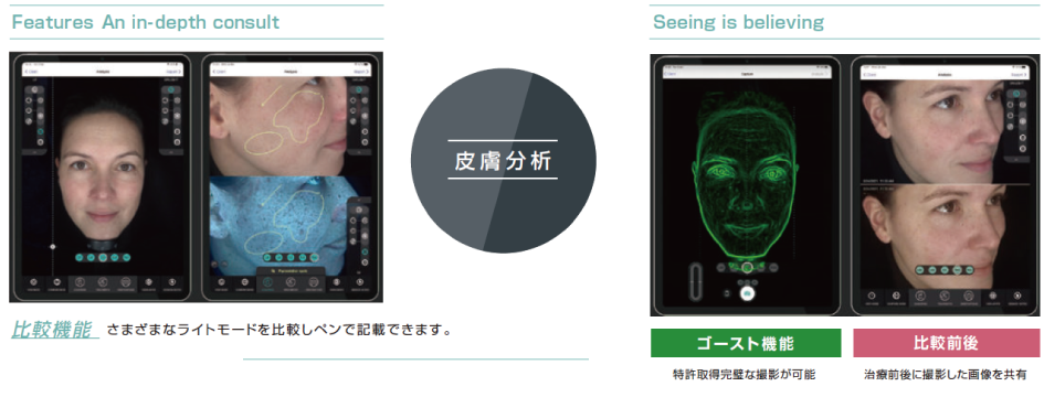 OBSERV 520x｜10モード対応スキン分析機器｜iPad連携で肌の深層まで可視化する美容クリニック向け装置