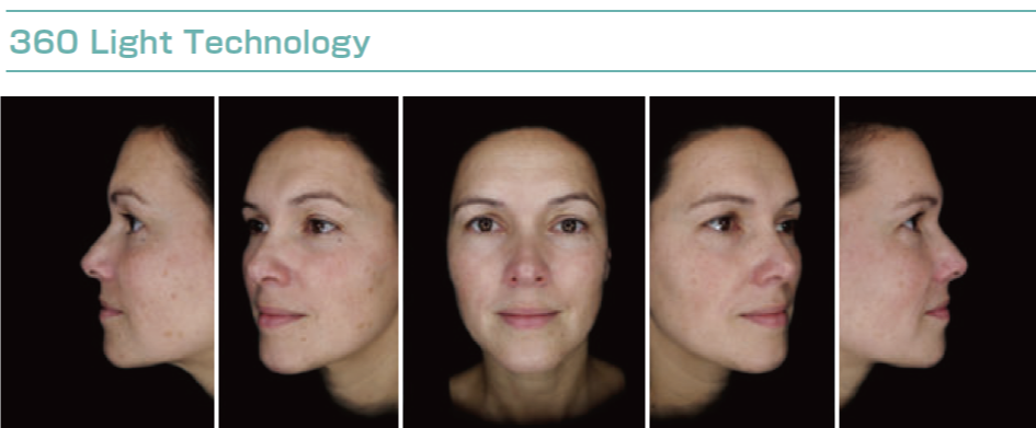 OBSERV 520x｜10モード対応スキン分析機器｜iPad連携で肌の深層まで可視化する美容クリニック向け装置