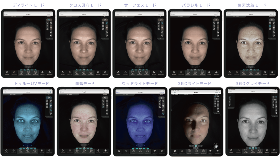 OBSERV 520x｜10モード対応スキン分析機器｜iPad連携で肌の深層まで可視化する美容クリニック向け装置