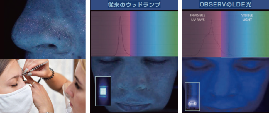 OBSERV 520x｜10モード対応スキン分析機器｜iPad連携で肌の深層まで可視化する美容クリニック向け装置