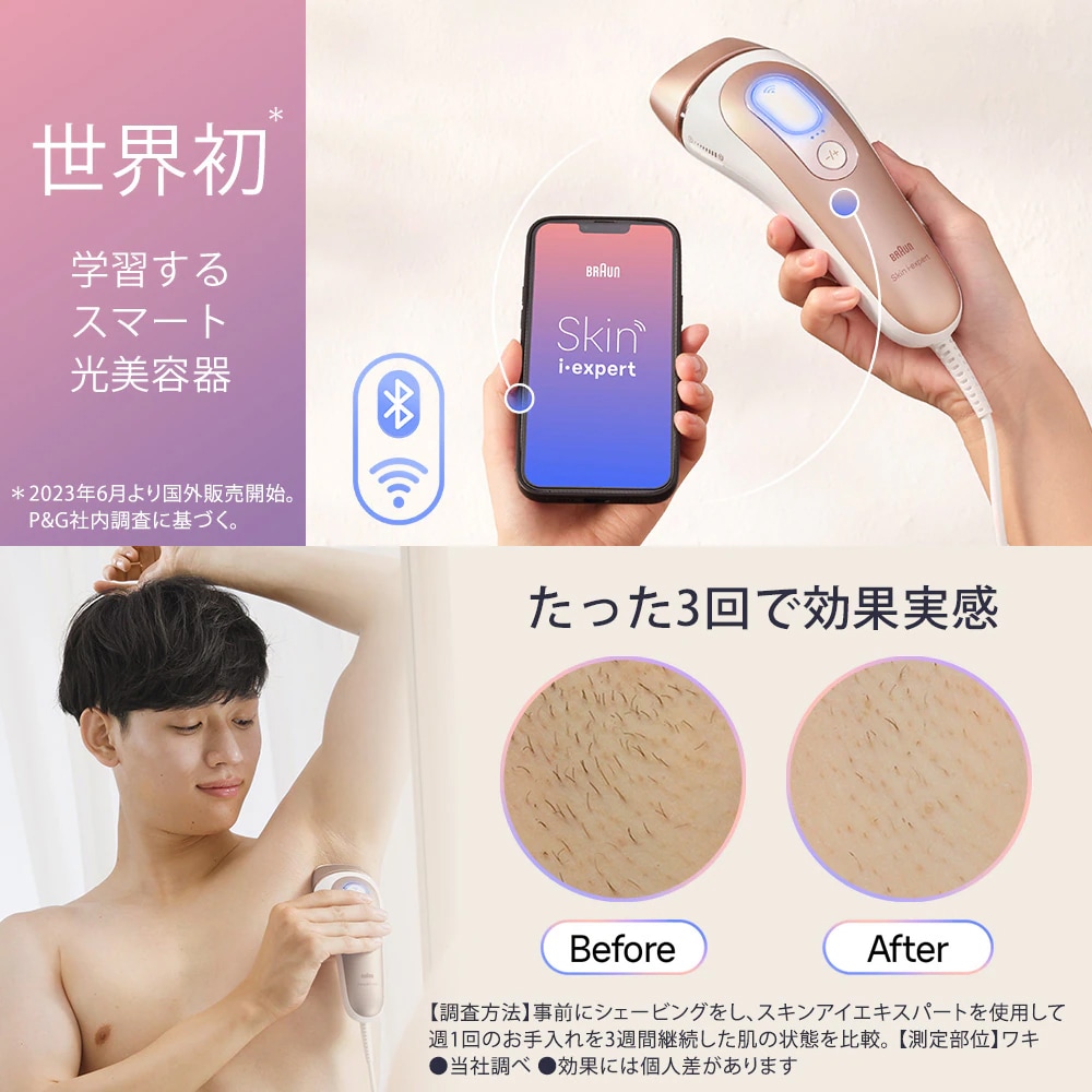 BRAUN スキンエキスパート ホワイト Amazon.co.jp: 【正規品】ブラウン 脱毛器 スキンアイ