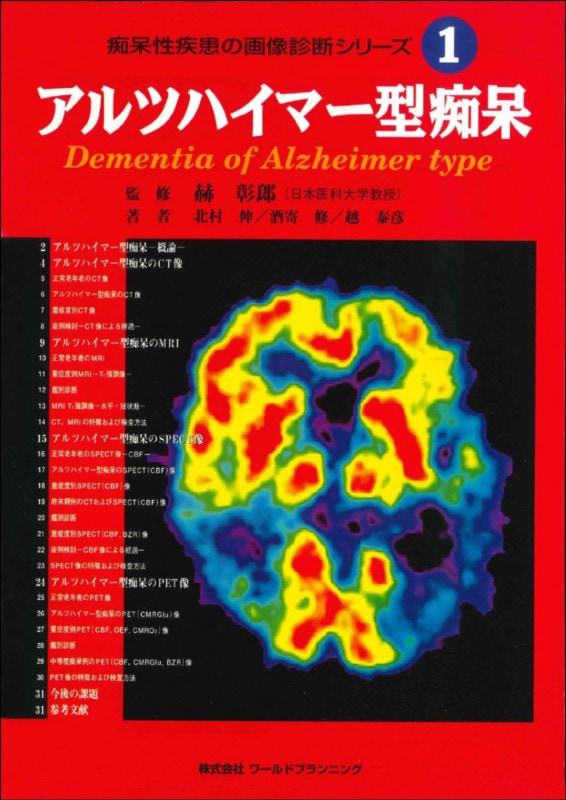 �����������β������ǥ��꡼��  (1)����ĥϥ��ޡ�