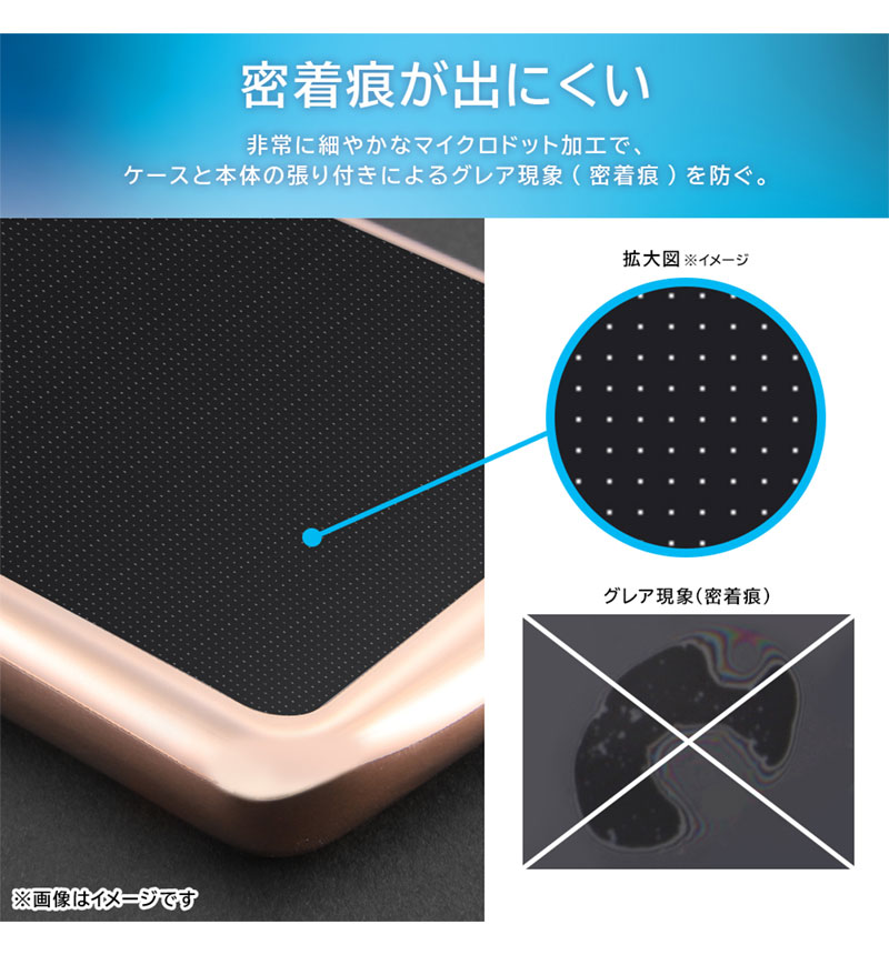 Xperia 10 V �Ѿ׷� TPU���եȥ����� METAMORU �֥�å� RT-RXP10M5TC13/BM