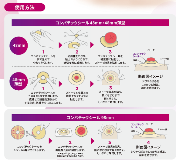 コンバテック シール｜ヤガミホームヘルスセンター e.よりそうだん