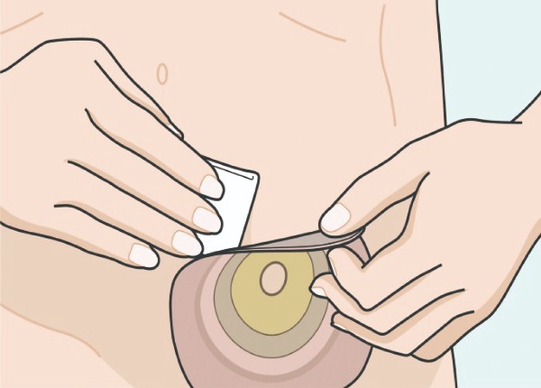 アダプト剥離剤パック｜ヤガミホームヘルスセンター e.よりそうだん