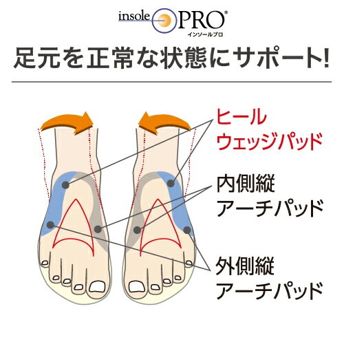 インソールプロ メンズ O脚対策 Mサイズ(25～25.5cm) ［1個］ 男性用 O